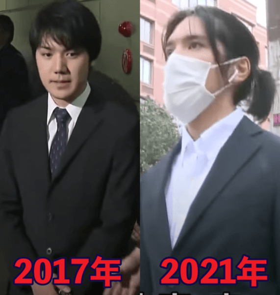 小室圭さんの渡米前と現在の顔の比較画像
